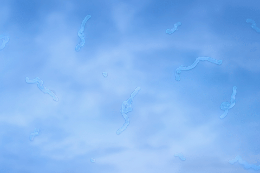 photo showing what eye floaters look like against a sky background