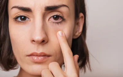 Why Are My Eyes Red? It Might Not Be Just Allergies