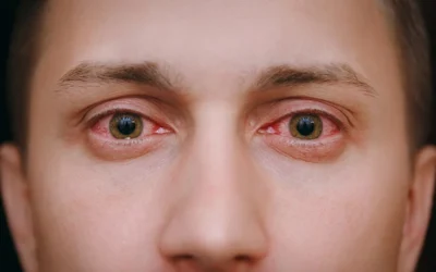 Pink Eye: Symptoms, Causes & Treatment